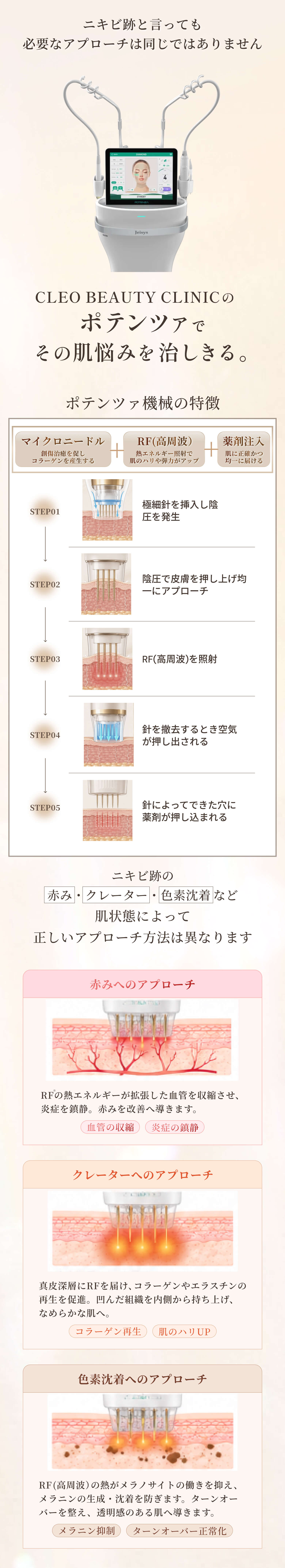 CLEO BEAUTY CLINICのポテンツァで自分の肌に自信を取り戻してみませんか？
