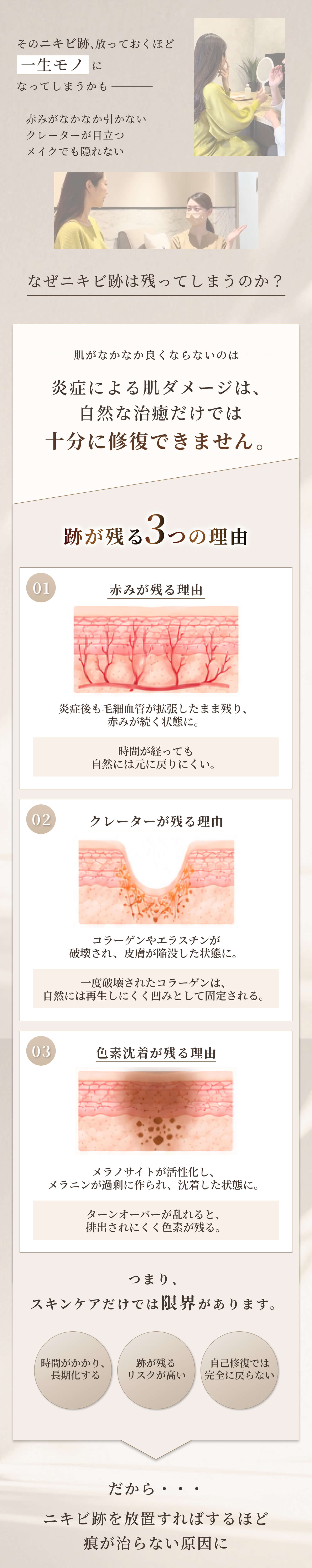 そのニキビ跡、放っておくほど一生モノになってしまうかも